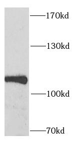 SECISBP2 Antibody - BSA Free