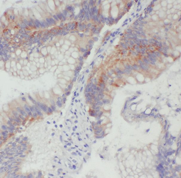 SDCCAG3 Antibody - BSA Free
