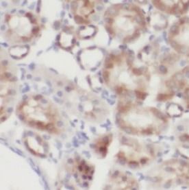 epithelial Sodium Channel alpha Antibody - BSA Free