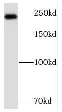 Nav1.7 Antibody - BSA Free