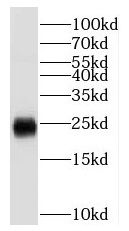 Scn2b Antibody - BSA Free