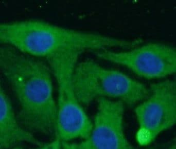 Nav1.8 Antibody - BSA Free
