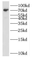 SCML2 Antibody - BSA Free