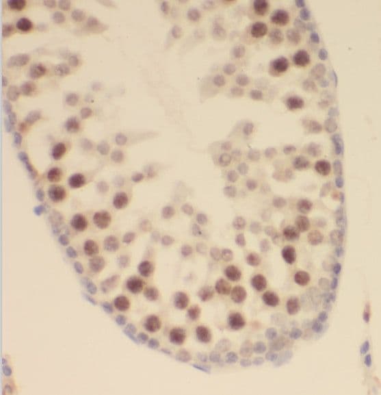 SCML2 Antibody - BSA Free