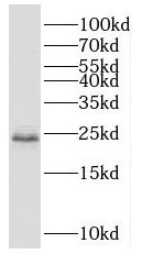 SCML1 Antibody - BSA Free