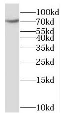 SCLT1 Antibody - BSA Free