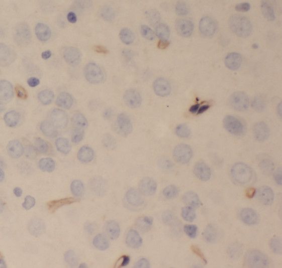SCHIP1 Antibody - BSA Free