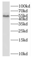 SCHIP1 Antibody - BSA Free