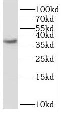 SCAMP1 Antibody - BSA Free