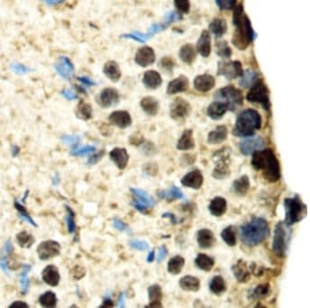 SBNO1 Antibody - BSA Free