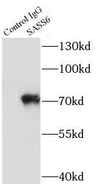 SASS6 Antibody - BSA Free