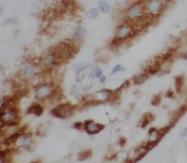 SASS6 Antibody - BSA Free