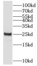 SAR1B Antibody - BSA Free