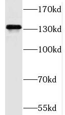 SAPS3 Antibody - BSA Free