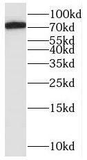 SAMD4B Antibody - BSA Free