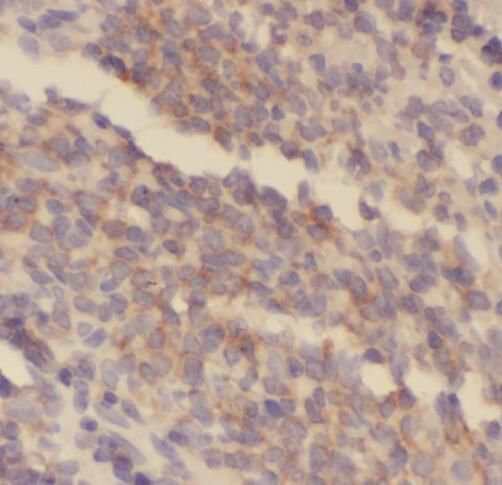 SAMD4A Antibody - BSA Free