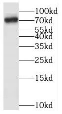 SAMD4A Antibody - BSA Free