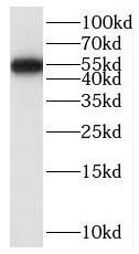 SAMD14 Antibody - BSA Free