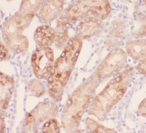 SAMD14 Antibody - BSA Free