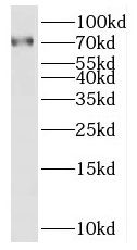 SAMD11 Antibody - BSA Free