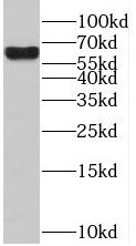 SACM1L Antibody - BSA Free