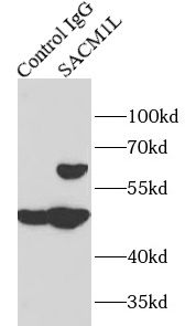 SACM1L Antibody - BSA Free