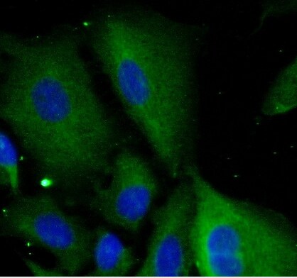 SAA2 Antibody - BSA Free