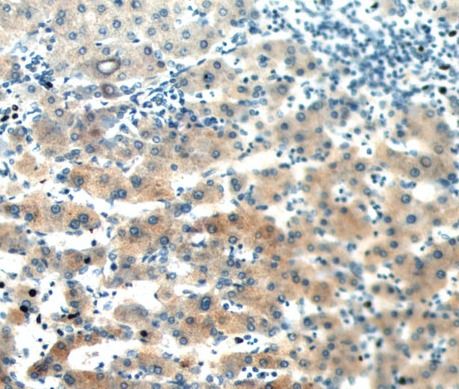 SAA2 Antibody - BSA Free