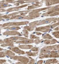 Ryanodine Receptor 2 Antibody - BSA Free