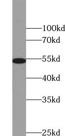 ZNF486 Antibody - BSA Free