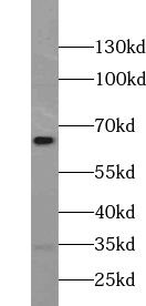 ZNF397 Antibody - BSA Free