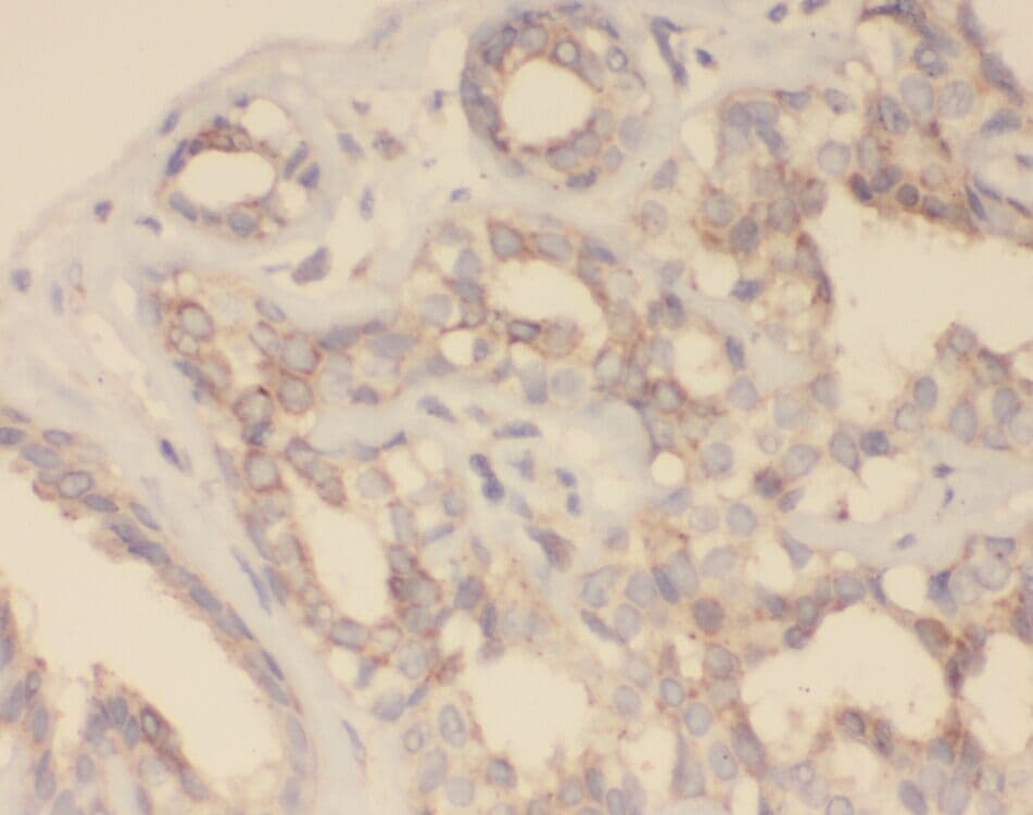 Zinc finger protein 395 Antibody - BSA Free