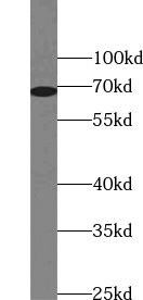 ZNF354A Antibody - BSA Free
