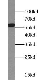 ZNF35 Antibody - BSA Free