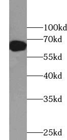 ZNF326 Antibody - BSA Free
