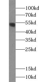 ZNF277 Antibody - BSA Free