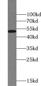 ZNF256 Antibody - BSA Free