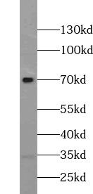 ZNF251 Antibody - BSA Free