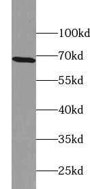 ZNF211 Antibody - BSA Free