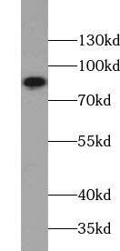 ZNF184 Antibody - BSA Free