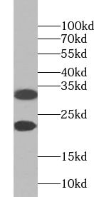 ZNF146 Antibody - BSA Free
