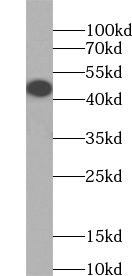 ZNF114 Antibody - BSA Free