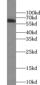 ZIM3 Antibody - BSA Free