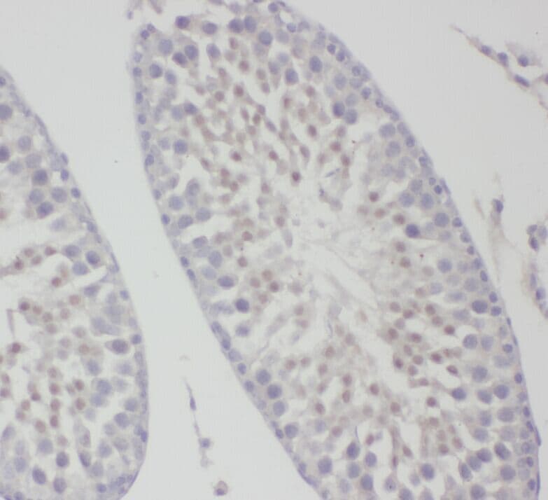 ZDHHC9 Antibody - BSA Free
