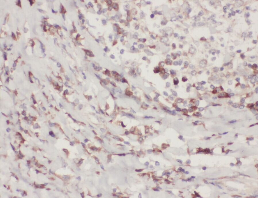 ZC3H4 Antibody - BSA Free