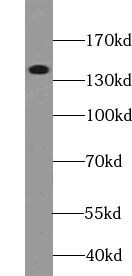 ZC3H4 Antibody - BSA Free