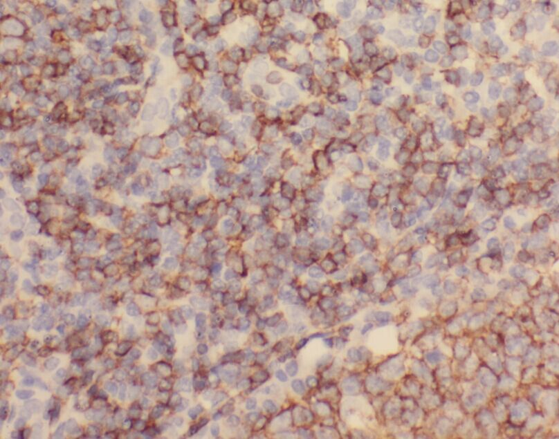 ZC3H12D Antibody - BSA Free