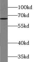 ZBTB46 Antibody - BSA Free