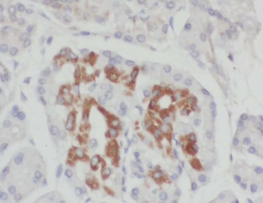 ZADH2 Antibody - BSA Free