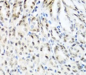 YTHDF3 Antibody - BSA Free